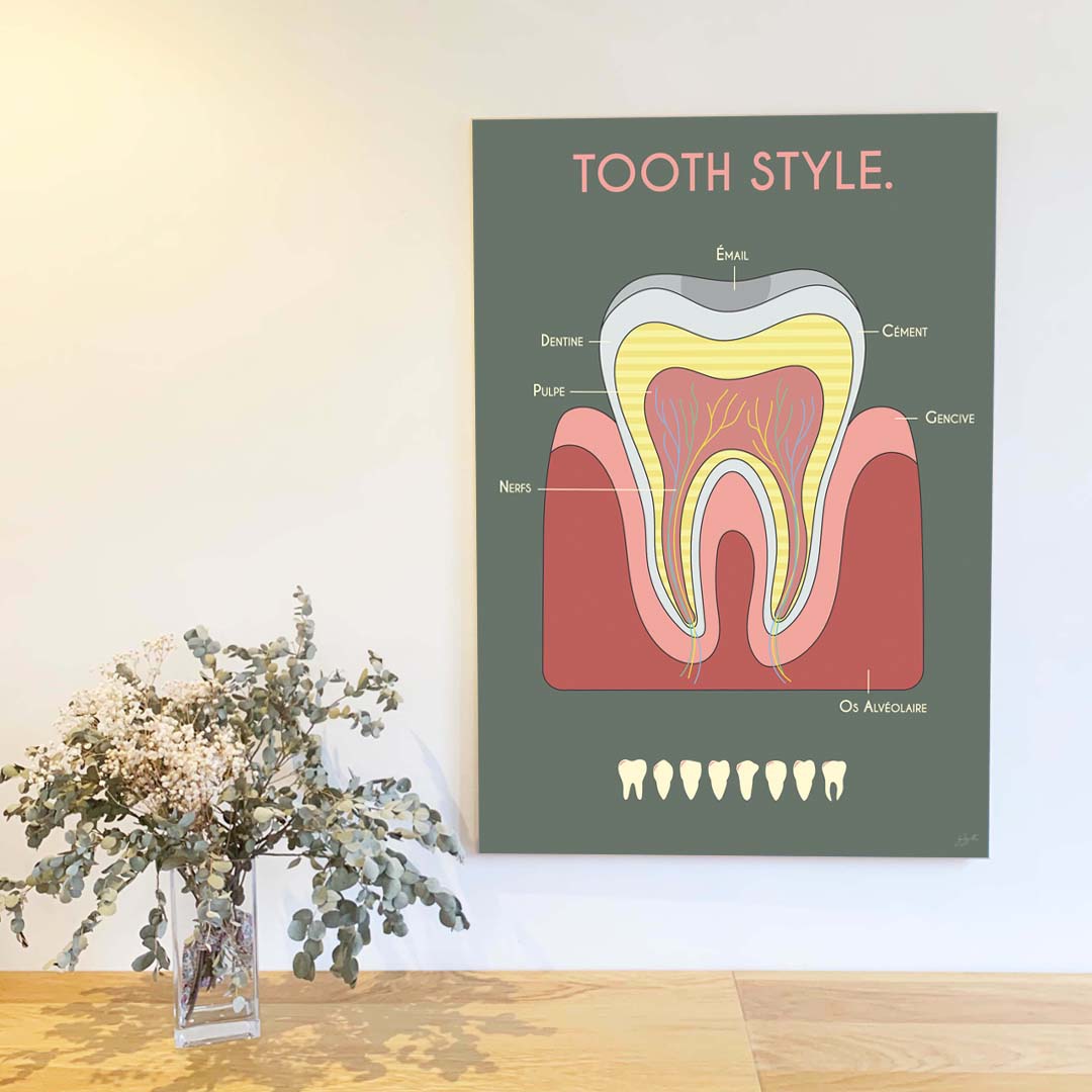 Grande affiche en bois Anatomie de la dent 70 × 100 cm, fond kaki, décoration murale originale pour cabinet de dentiste.